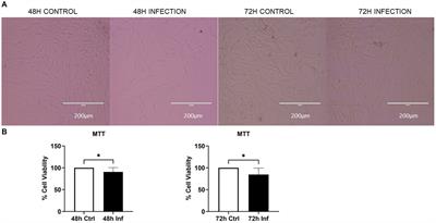 Feline coronavirus influences the biogenesis and composition of extracellular vesicles derived from CRFK cells